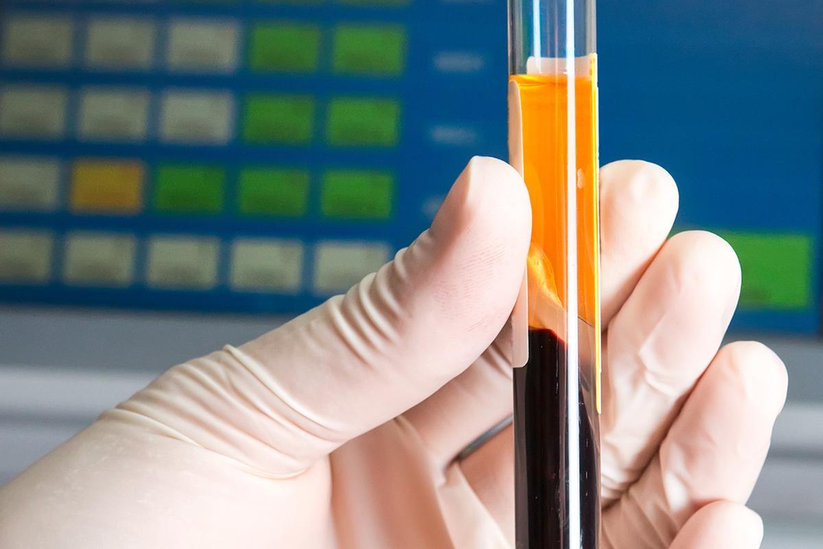 Regenerative Medicine