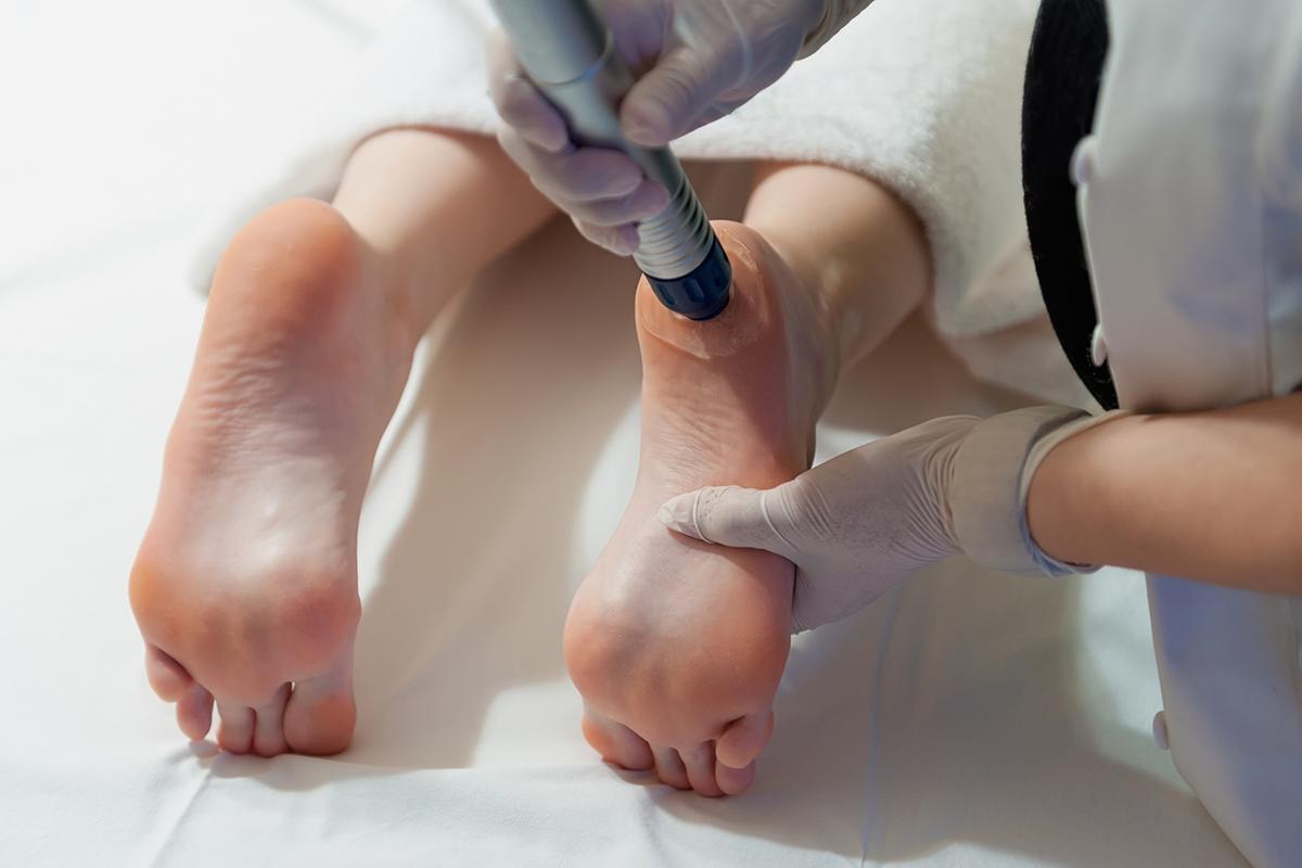 EPAT Shockwave Therapy