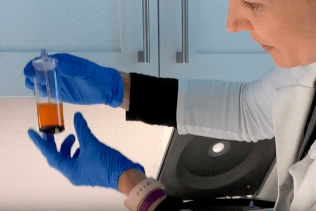Concentrating stem cells